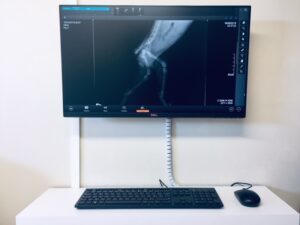 Lire la suite à propos de l’article Radiographie